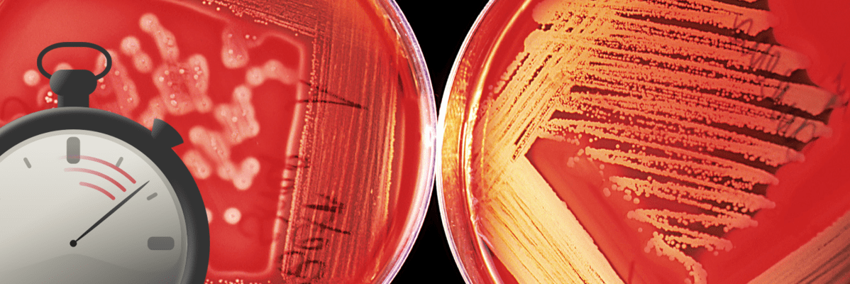 Blood Cultures Before Antibiotics&nbsp;Matter